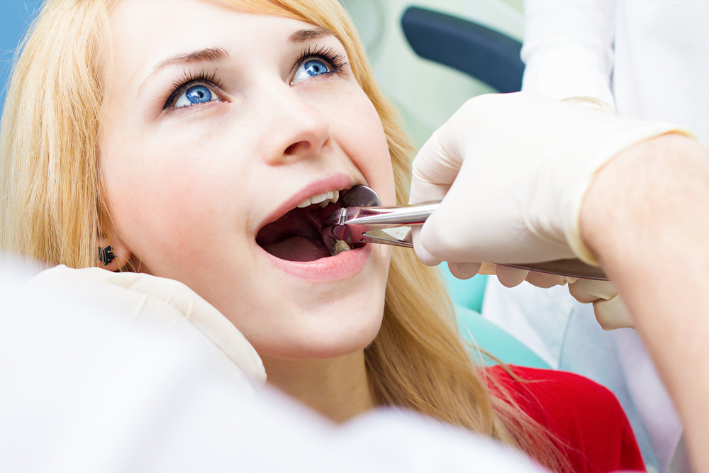 Wisdom Tooth Removal – Aftercare